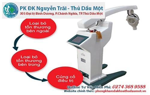 Phương pháp ALA – PDT - chữa sùi mào gà hiệu quả nhất hiện nay