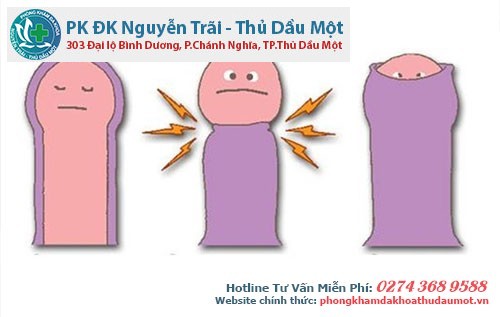 khi gặp một trong các trường hợp về bao quy đầu