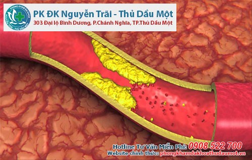 cholesterol xấu - LDL trong máu tăng lên có thể là do huyết thống di truyền